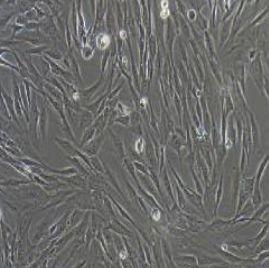 人胰腺肿瘤成纤维细胞永生化