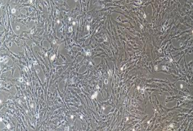 鸡气管黏膜上皮细胞永生化