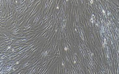 人胰腺癌相关成纤维细胞永生化
