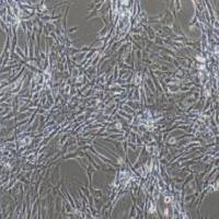 鸭脑微血管内皮细胞永生化