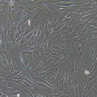 人胰腺癌细胞永生化