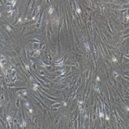 兔子宫内膜上皮细胞永生化
