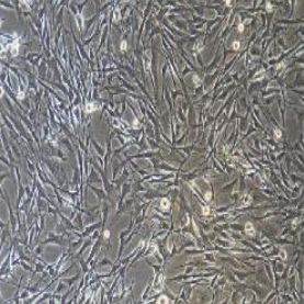 小鼠肺成纤维细胞/永生化细胞