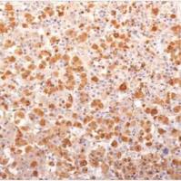 ACTH 单克隆小鼠抗体 (57),R-PE (PE),0.1 mg/mL BNCR0139