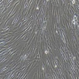 人胰腺癌相关成纤维细胞永生化