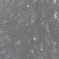 人胰腺癌相关成纤维细胞永生化