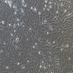 小鼠肝星状细胞永生化