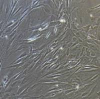 人卵巢癌细胞永生化