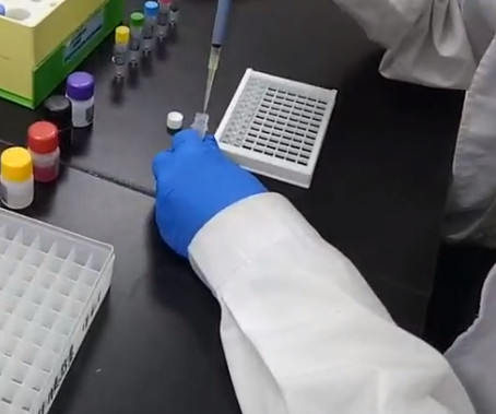 ELISA试剂盒试验代测中什么是需求留意的呢