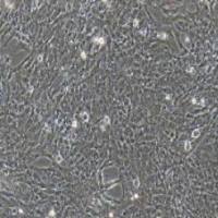 鸡胚成纤维细胞永生化