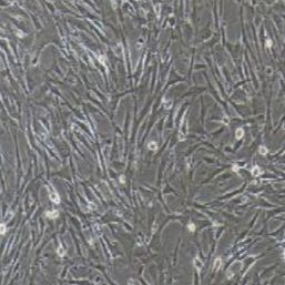 小鼠胰腺星状细胞永生化