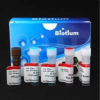 实时PCR细菌活力试剂盒 - Mycobacterium tuberculosis (groEL2