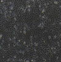 羊睾丸间质细胞永生化