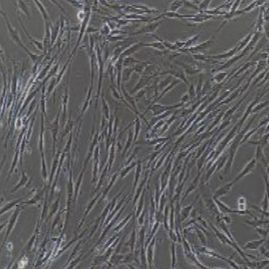 人胆囊上皮细胞永生化