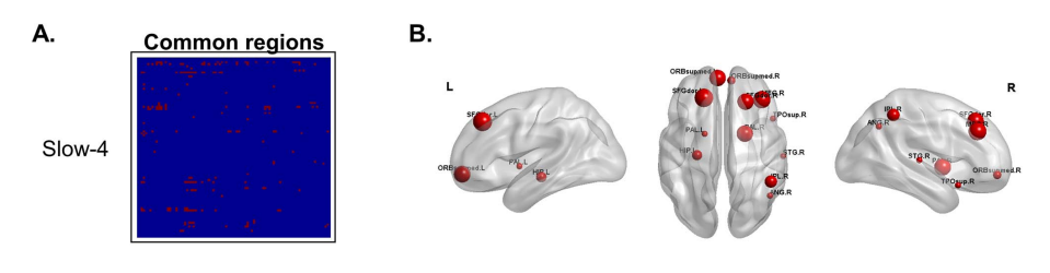 深圳市康宁医院科研成果:额极的经颅直流电刺激对大脑功能网络的影响