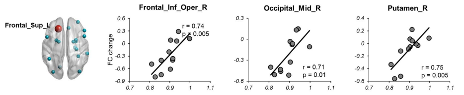 深圳市康宁医院科研成果:额极的经颅直流电刺激对大脑功能网络的影响