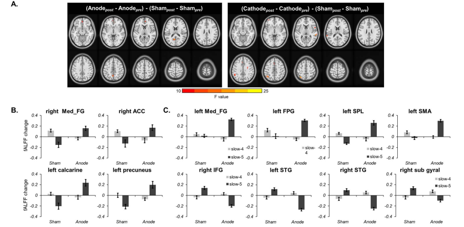 深圳市康宁医院科研成果:额极的经颅直流电刺激对大脑功能网络的影响