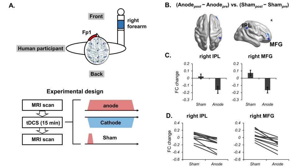 深圳市康宁医院科研成果:额极的经颅直流电刺激对大脑功能网络的影响
