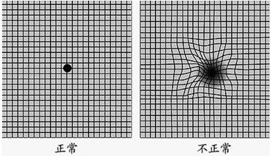 我戴上老花镜看实物，直线变成曲线了