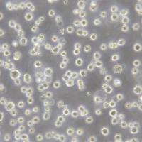 DB人弥漫性大B细胞淋巴瘤细胞