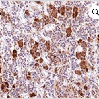 ACTH 单克隆小鼠抗体 (AH26),APC,0.1 mg/mL BNCA0026-250