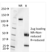 铜绿假单胞菌血清型6C单克隆小鼠抗体 (1200/472) CF660R BNC610240