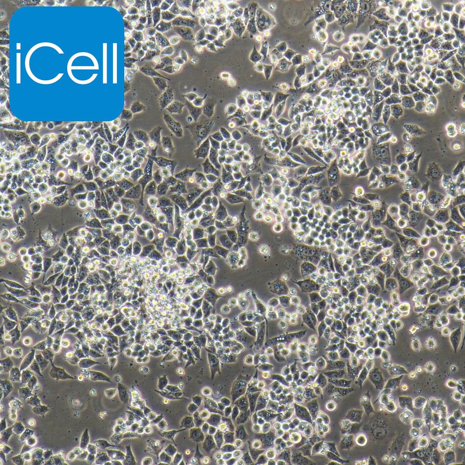 A2780+GFP 人卵巢癌细胞+GFP/STR鉴定/镜像绮点（Cellverse）