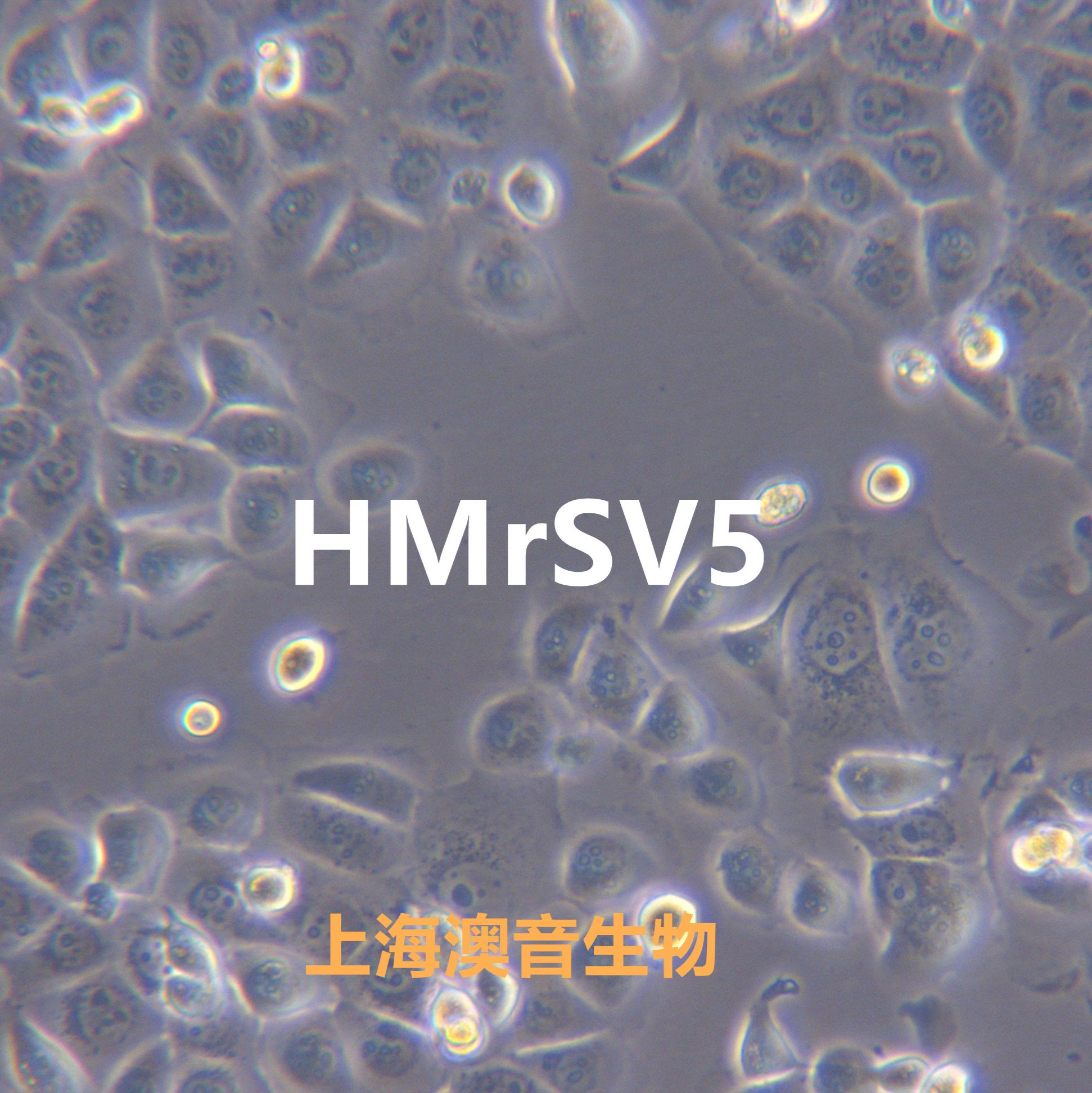 HMrSV5人腹膜间皮细胞