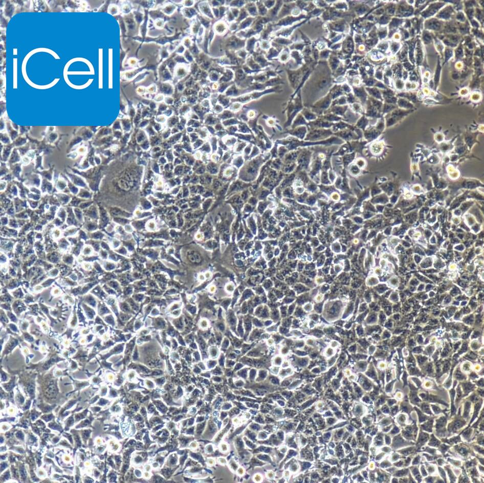 GL261+luc 小鼠胶质细胞瘤+luc /STR鉴定
