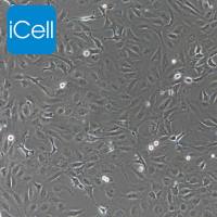 SK-OV-3+luc 人卵巢癌细胞荧光素酶标记 /STR鉴定