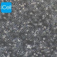 ASPC-1/GEM 人转移胰腺腺癌细胞吉西他滨耐药株/STR鉴定