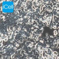 LOVO/5FU 人结直肠癌细胞氟尿嘧啶耐药株/STR鉴定