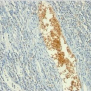 一磷酸腺苷脱氨酶-3单克隆小鼠抗体 (AMPD3/901),APC,0.1 mg/mL BNCA0901-250