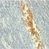 一磷酸腺苷脱氨酶-3单克隆小鼠抗体 (AMPD3/901),CF®405M,0.1 mg/mL