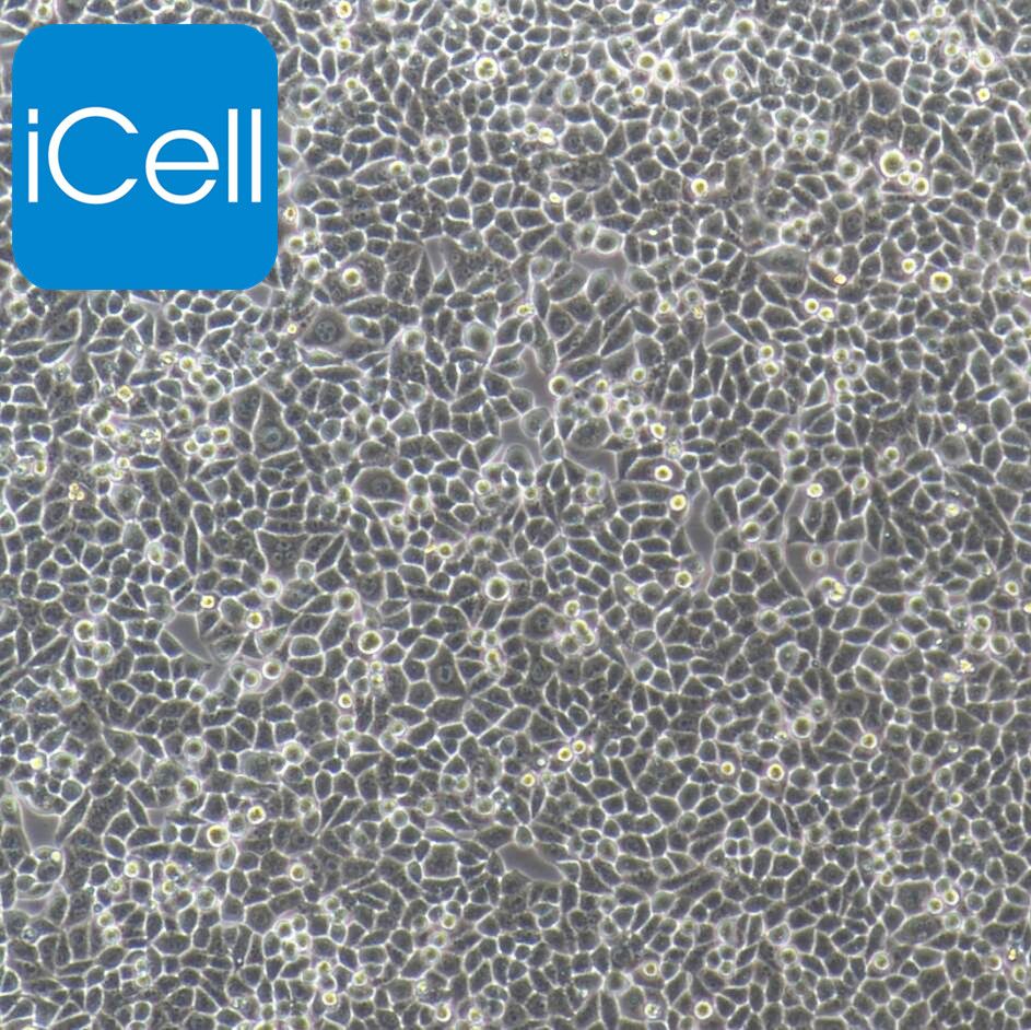 HELA+luc 人宫颈癌细胞HELA荧光素酶标记 
