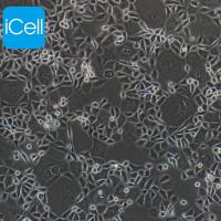 HCT-15/5FU 人结直肠癌氟尿嘧啶耐药株/STR鉴定