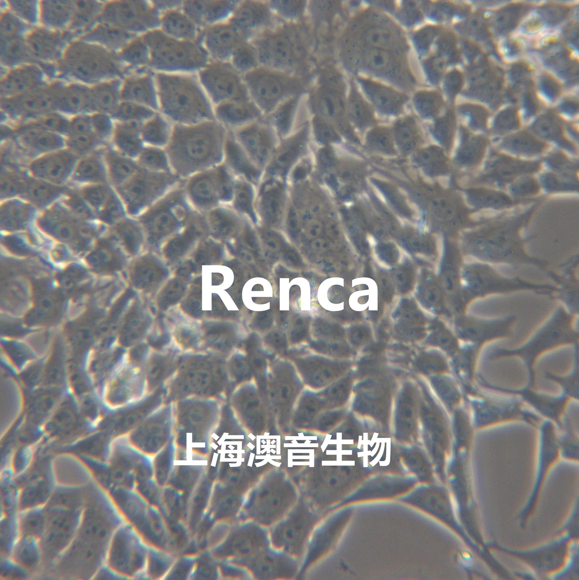 Renca[Renca; RENCA; Renal Carcinoma]小鼠肾癌细胞