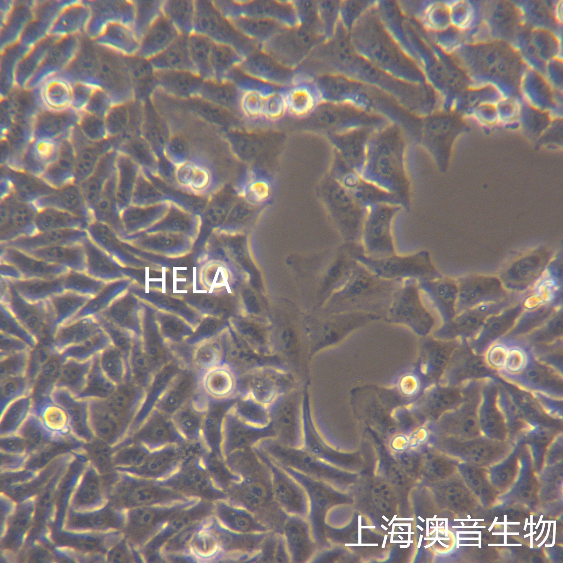 HeLa[HELA; Hela; He La; He-La; Henrietta Lacks cells]宫颈癌细胞