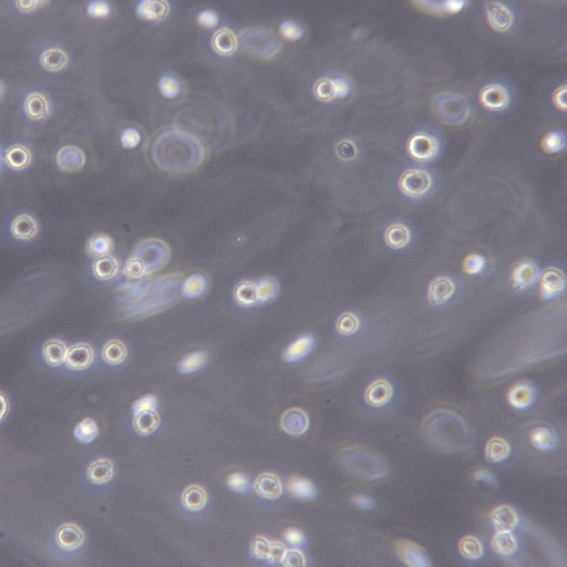 THP-1[THP1; THP 1; THPI; THP-1(ATCC); Tohoku Hospital Pediatrics-1]单核细胞白血病细胞