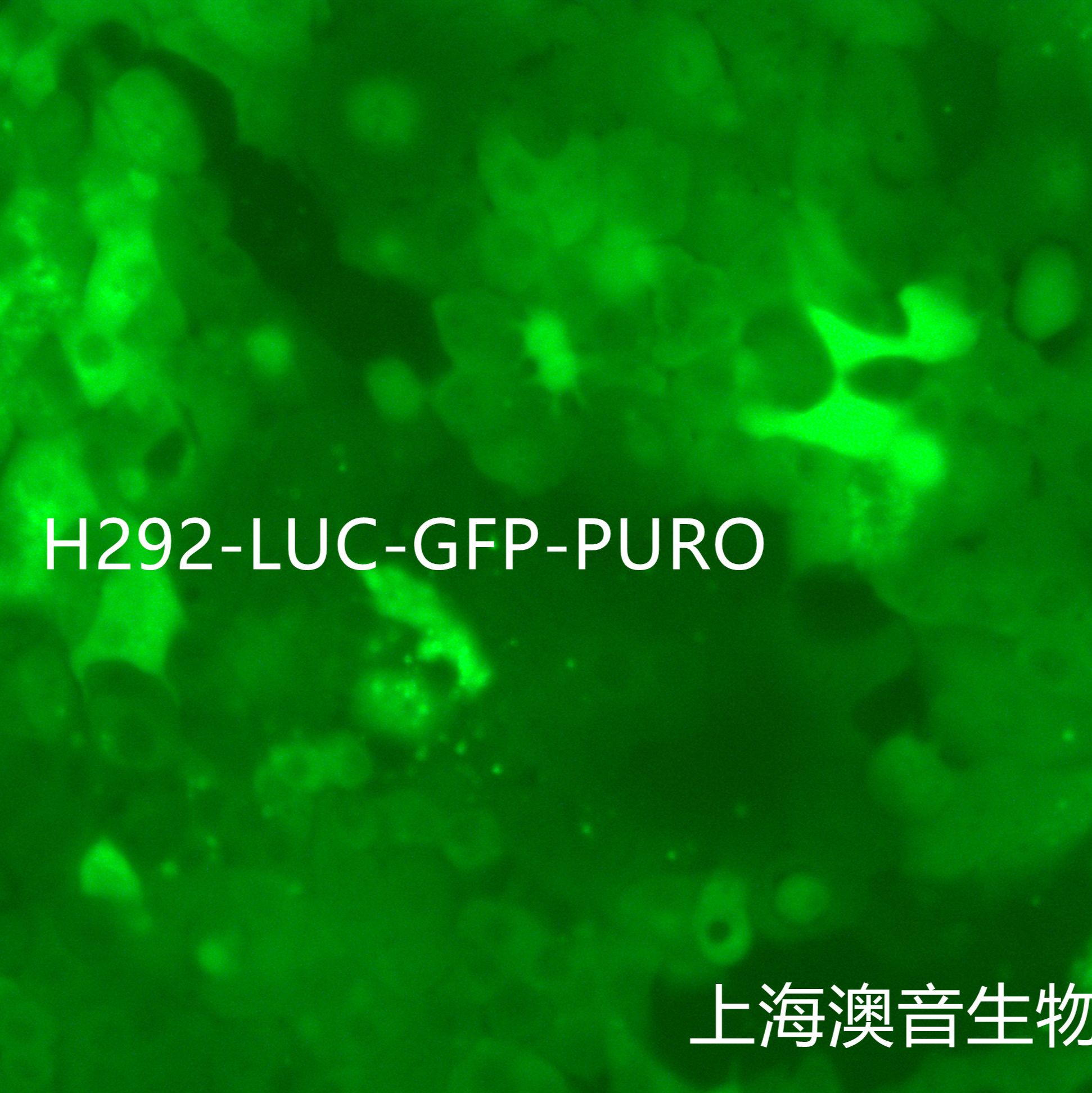 NCI-H292-LUC-GFP-Puro【H292-LUC;H292-GFP】双标记的人肺粘液上皮样癌细胞