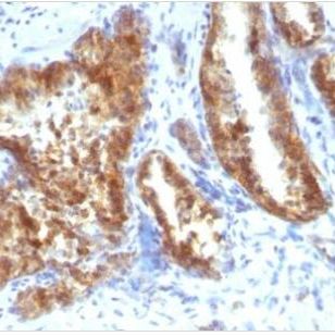 AMACR / p504S 兔多克隆抗体 (PAb) BNC880731-500