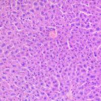 HE染色-伊红染色法 