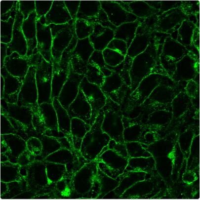 DNP 兔多克隆抗体 CF488 DNP 20866-250uL