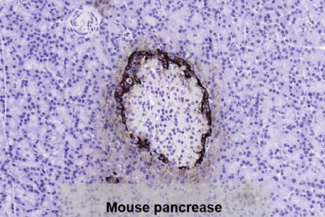 两个针对糖尿病靶标的优质抗体