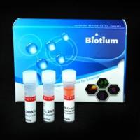 NucView 488和RedDot 2凋亡和坏死试剂盒 (100 assays) 30072