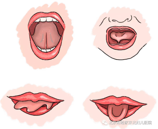 宝宝翘舌音不清晰？可能是舌系带出了问题