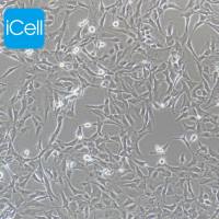 Calu-1细胞 | Calu1细胞 | Calu-1 | Calu1 | Calu1人