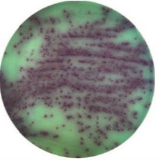 假单胞菌显色培养基