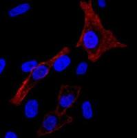 Cholera Toxin Subunit B, CF488A conjugate 00070