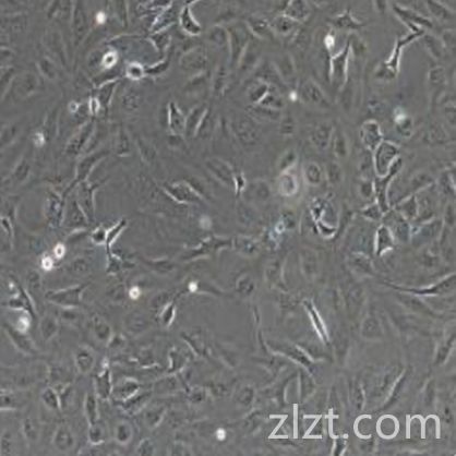 SK-OV-3+luc 人卵巢癌细胞荧光素酶标记